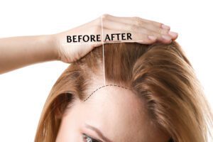 A woman is holding up her hair before and after